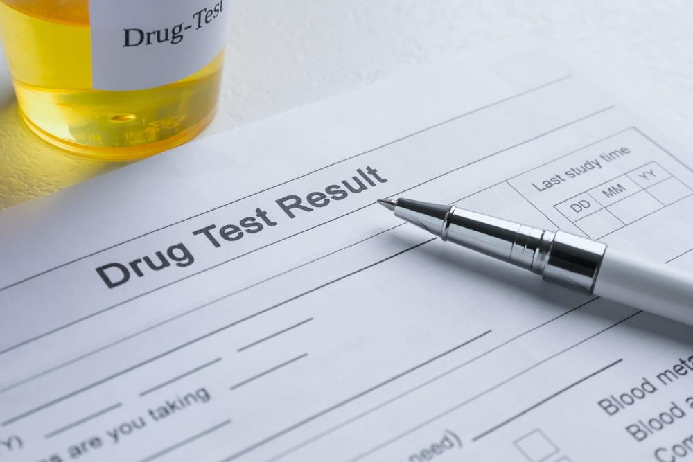 Form showing drug test results and a vial of urine testing for meth use