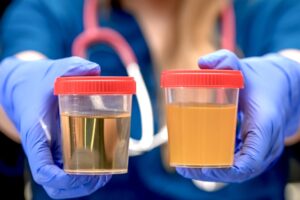 Lab technician holding two small plastic containers of urine for meth testing